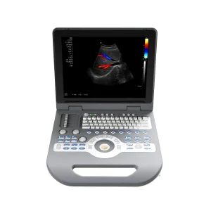 Ltub65 Económico 3D/4D Sistema de Ultrasonido