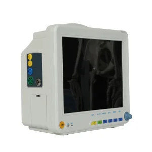 Preço Barato SpO2 Etco2 com Suporte de Parede para Dispositivo 6 Paramet Monitor de Paciente em UTI