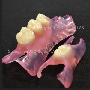 Custom Affordable Clear Pink Removable Partial Valplast Dentures with Flexible Base Acrylic Teeth