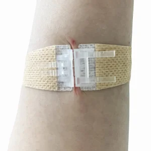 شريط لاصق طبي أبيض disposable لإغلاق الجروح