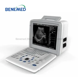 Clear Image Ultrasound