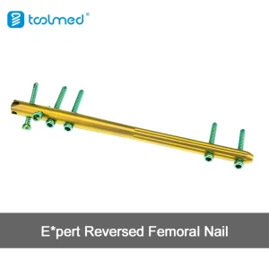 Proximal Femoral Nail