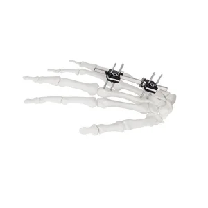 Straight Type Fixator