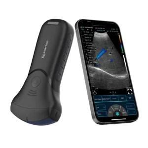 Handheld Ultrasound