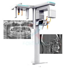 CBCT X-Ray