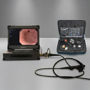 Diagnostic Gastroscope Video Endoscope Endoscopy Instrument Imaging System for Surgery Examination