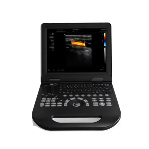Escáner laptop móvil
