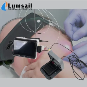 1470nm Endolift