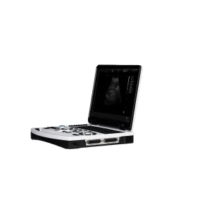 Mt-690 Point of Care Laptop Ultrasound Black and White Scanner