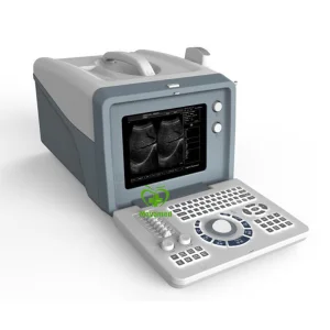 My-A001A Equipo de diagnóstico médico barato máquina de ultrasonido portátil