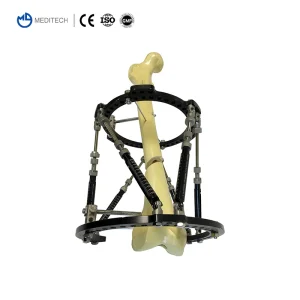 Ilizarov Fixation System