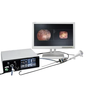 HD Endoscopic Camera System 2 in 1 Medical for Laparoscope Surgery OEM Service