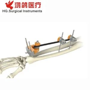 Orthopedic Combination External Fixator Forearm Fixator Orthopedic External Orthopedic Products Medical Instrument