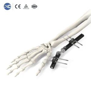 Wrist External Fixator