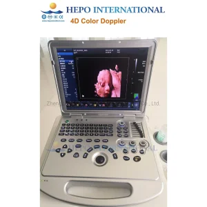 Laptop Fetal Color Doppler