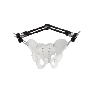 Pelvic External Fixator