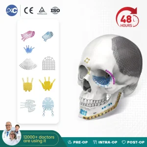 Maxillofacial Anatomical Orbital Floor Orthopedic Implant 1.5mm Series Bone Plate