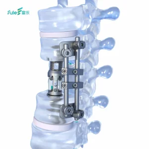 Fava Titanium Artificial Vertebral