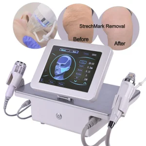 Portable 2 in 1 RF Microneedling Secret