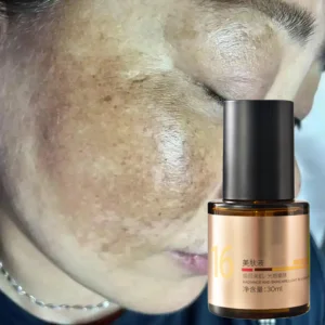 Chelation Blemish Serum for Hungary