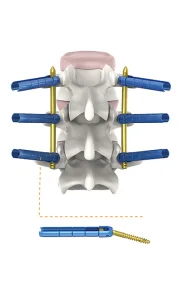 Surgical Medical Device