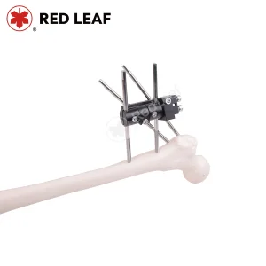 Pertrochanteric Orthopedic External Fixator Medical Extremities Fracture Fixation