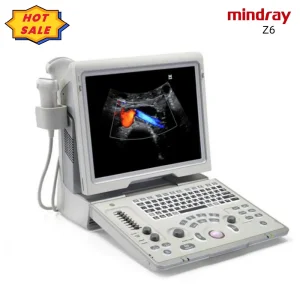 Mindray Ultrasound
