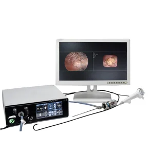 Manufacturer Medical 2 in 1 Integrated Rigid Endoscopy and Flexible Endoscopic System