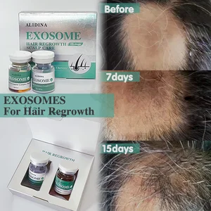 S Active Plant-Exo Anti-Hair Loss Solution