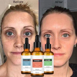 Suero blanqueador retinol hialurónico