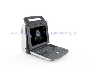 Color Doppler Ultrasound