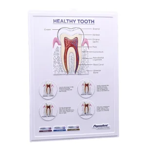 Concave and Convex Stereoscopic Picture