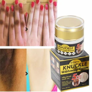 RTS Skincare (New) Private Label Hyaluronic Acid Knees Dark Elbows Lightening Skin Best Whitening Cream Dark Knuckles Removal
