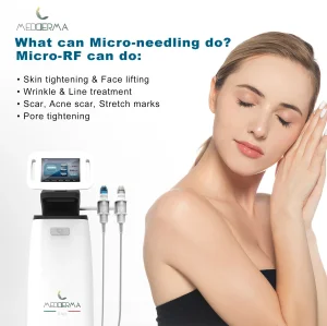 Advanced Microneedling and Radio Frequency Facial Treatment Tool