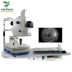 Fluorescein Angiography