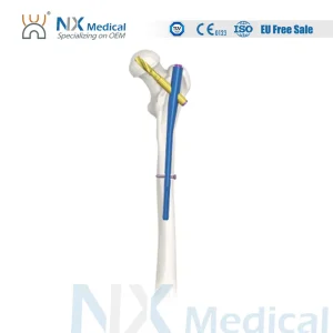 PFNA Titanium Nail
