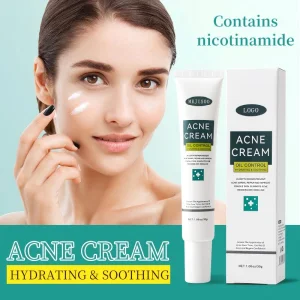 Acne Face Cream
