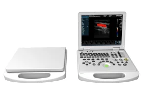 Máquina de ultrasonido portátil 3D/4D/5D