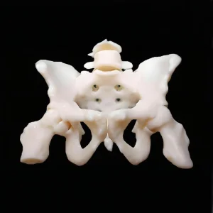Custom SLA 3D Printing Vacuum Casting Rapid Prototype Service for Medical Model