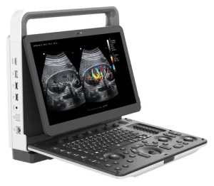 4D Color Ultrasound China