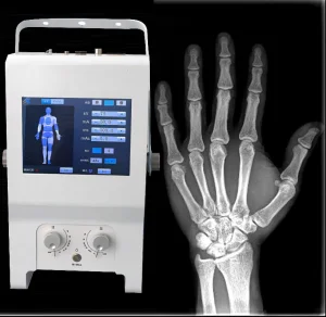 High-Tech X-ray Machine