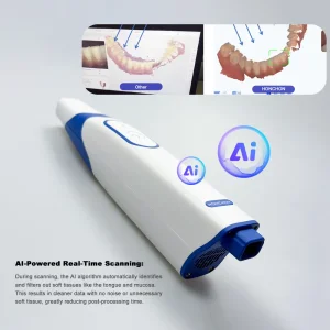 Intraoral Scanner