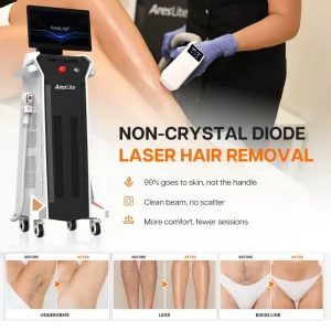 Máquina de Remoção de Pelos a Laser Diodo Painless
