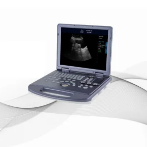 2025 China Full Digital Ultrasound