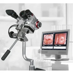 Colposcope Colposcopy Colposcope HD Digital Video Colposcope for Gynecology Colposcopy