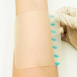 Hydrocolloid Dressings