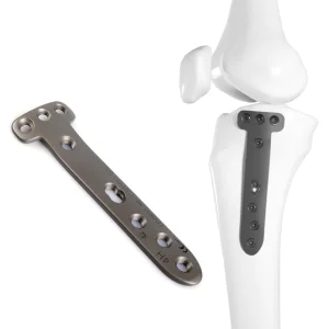 CANWELL Titanium Proximal Tibia Locking Plate