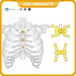 Titanium Sternum Plate