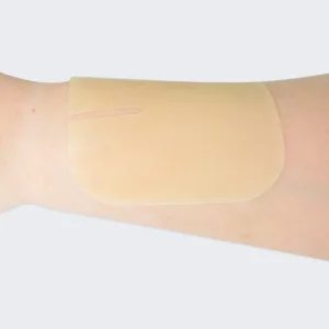 Hydrocolloid Dressing