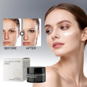 Best Skin Whitening Cream